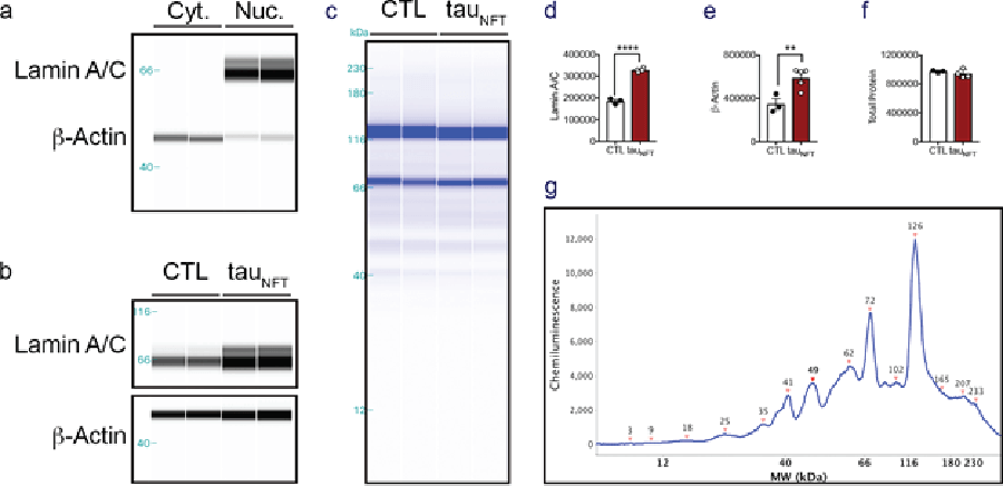 Using Total Protein Detection as an internal loading control when quantifying protein in tau transgenic mice.
